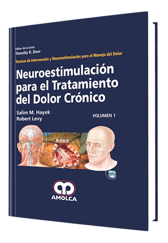 Neuroestimulación Para Tratamiento Del Dolor Crónico. Amolca