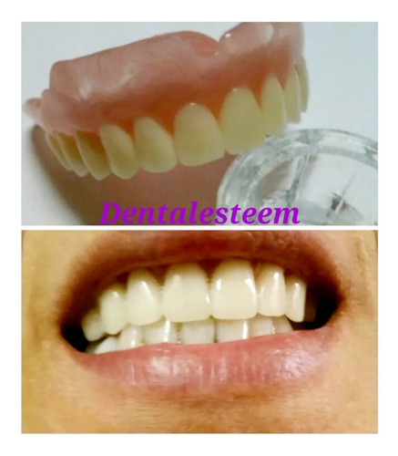 Imagen 1 de 5 de Prótesis Dentales Dentista Placas De Contencion Y Bruxismo