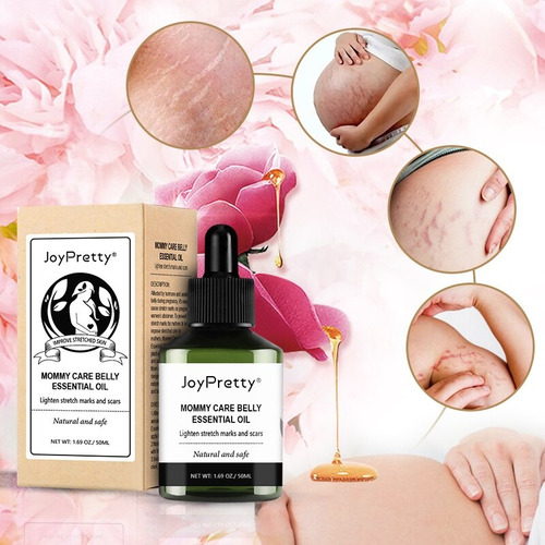 Aceite Para Eliminar Las Estrias - Joypretty 50 Ml