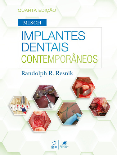 Misch - Implantes Dentais Contemporâneos, de Resnik, Randolph R.. Editora Gen – Grupo Editorial Nacional Part S/A, capa mole em português, 2022