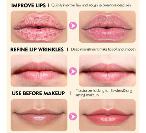 Exfoliante Labial, Exfoliante Blanqueador De Labios Para R