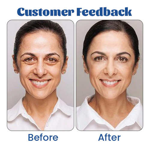 O Creme De Olhos T Retinol Aperta Os Olhos, Reduz A Linha Fi