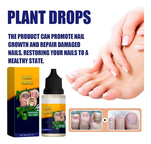 Gotas De Plantas Para El Cuidado De Las Uñas, Aceite De