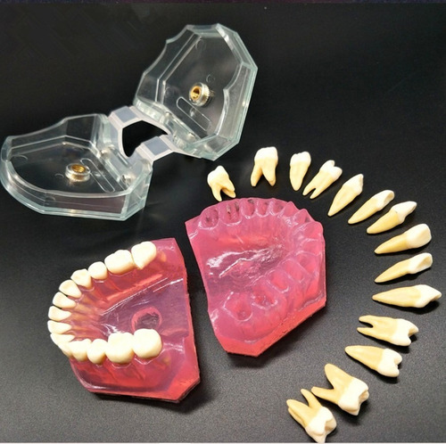 Imagen 2 de 10 de Modelo Acrílico Único Dientes Desmontables Encía Enseñanza