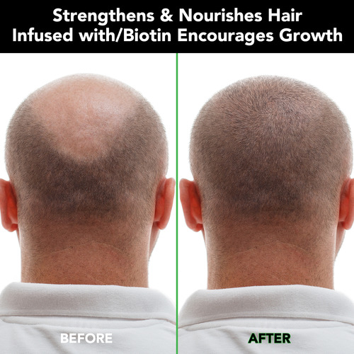Shampoo Cuidado Capilar Ricino Negro Biotina Fortalecedor