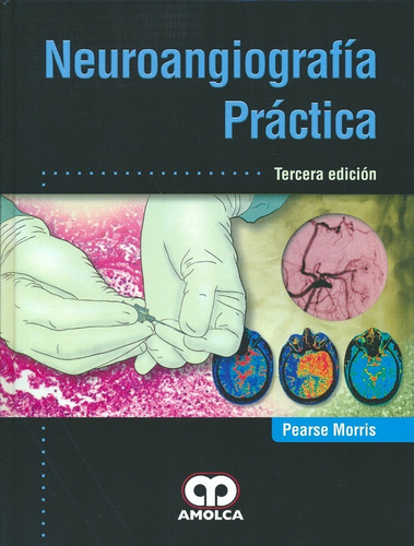 Libro Neuroangiografía Práctica.