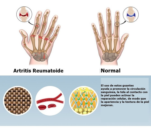 Imagen 7 de 8 de Guantes Para La Artritis Elasticados