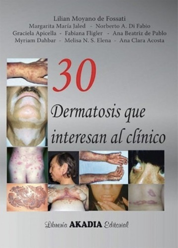 Fundamentos En Dermatología Clínica - Gatti, Carlos, De Lilian Fossati. Editorial Journal En Español