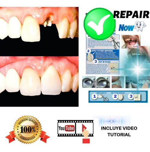Imagen 3 de 6 de Kit Dentadura Provisoria Postiza Cosmética Agnovedades