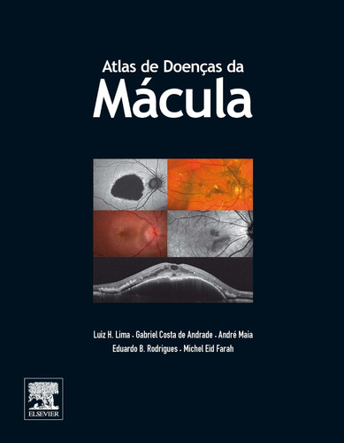 Atlas De Doenças Da Mácula