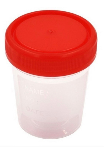 Imagen 2 de 6 de Frasco Recolector De Orina Esteril 120 Ml X 100 U