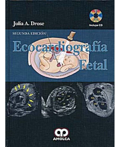 Ecocardiografia Fetal 2 Edicion