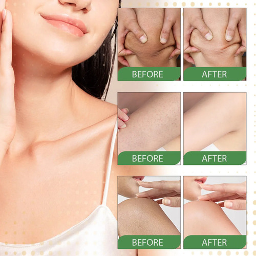 Crema De Colágeno, Loción Corporal E Hidratante Facial