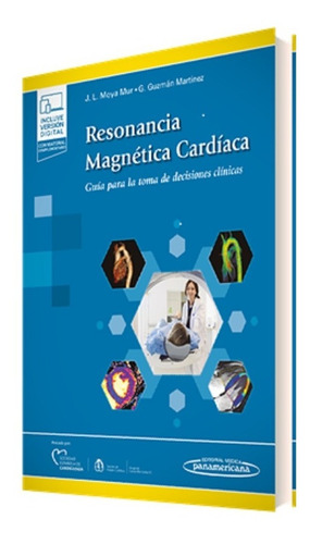 Resonancia Magnetica Cardiaca (duo) Moya