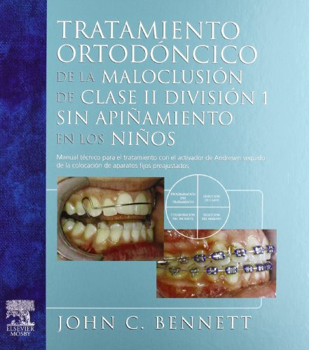 Libro Tratamiento Ortodoncico De La Maloclusión De Clase Ii