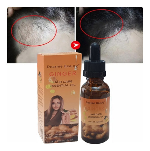  Serum Ginger Para Crecimiento Del Cabello Y Antiestres  5.5