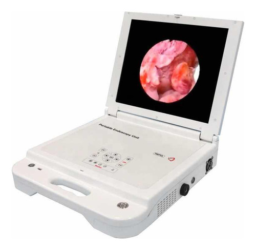 Equipo Cámara Endoscopia Portátil Ful Hd Monitor De 17 