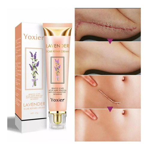  Pomada Creme Yoxier Remove Tira Cicatrize Queloide 20g