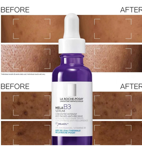 10% B3 Esencia Antimanchas Oscuras De Nicotina Pura 30 Ml