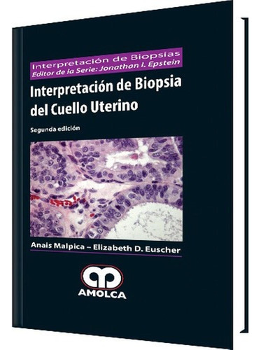 Interpretacion De Biopsia Del Cuello Uterino Malpica
