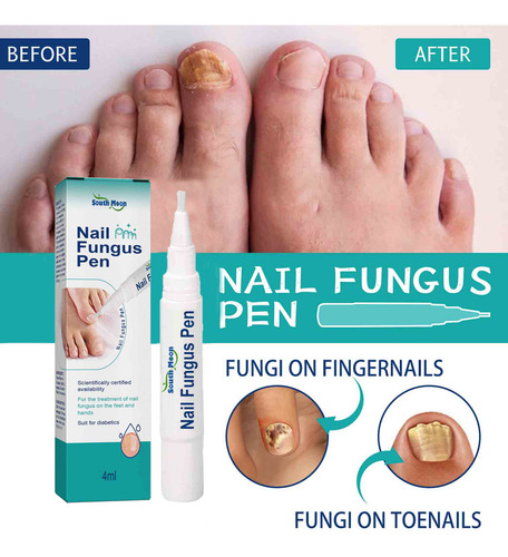 Canetas Reparadoras De Unhas E Unhas Dos Pés Para Melhorar A