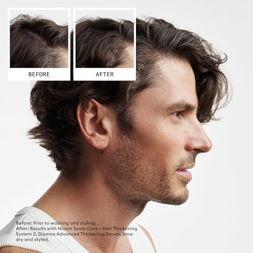 Pré-pacote De Shampoo E Condicionador Nioxin System 2, Cabel