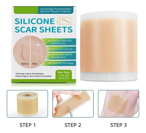 Parches De Silicona Para Cicatricescinta De Silicona