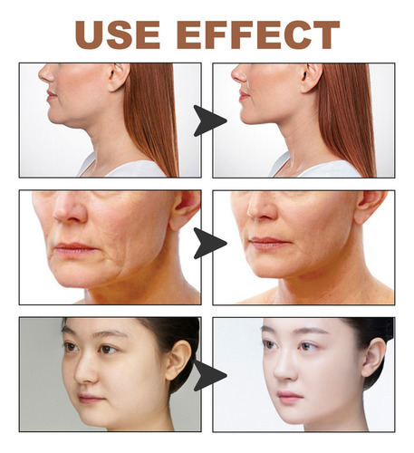 Q Cinturón De Estiramiento Facial Miofascial J Antiflacidez