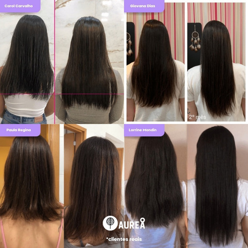 Imagem 3 de 9 de Aurea Beauty Remedio Para Crescer Cabelo Feminino Rapido