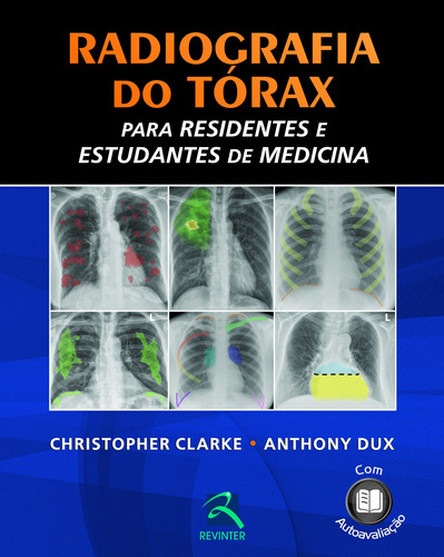 Radiografia do Tórax, de Clarke, Christopher. Editora Thieme Revinter Publicações Ltda, capa dura em português, 2012