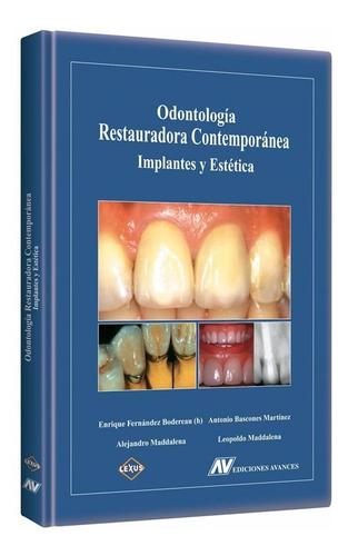 Libro Odontología Restauradora Contemporánea- Bodereau