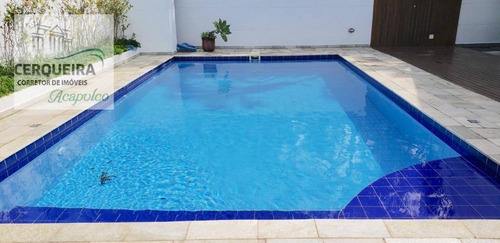 Casa Com 6 Dormitórios À Venda, 420 M² Por R$ 2.100.000 - Acapulco - Guarujá/sp - Ca0573