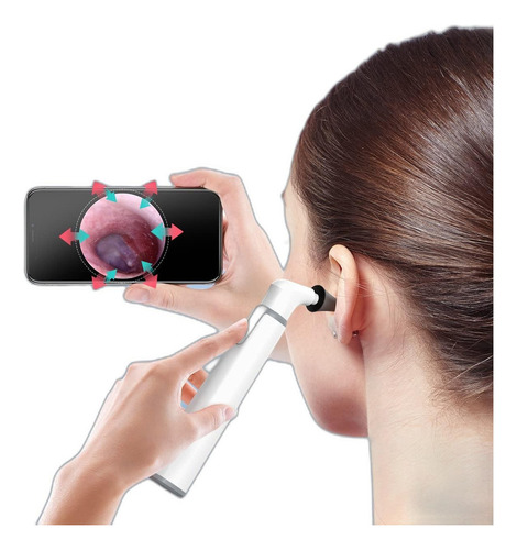 Camara Inalambrica Otoscopio Con Vista Dual Wifi 720phd Led