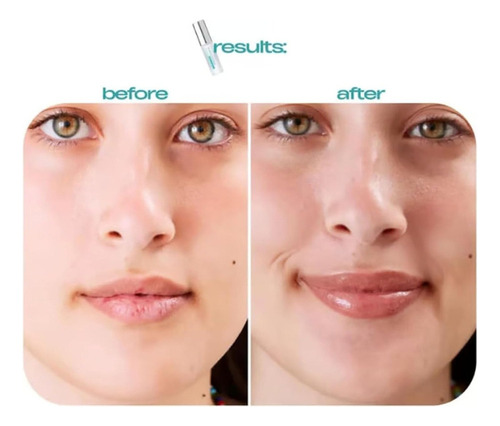 Spicule Plumping Lip Shot Hidratante Coreano De Larga Duraci