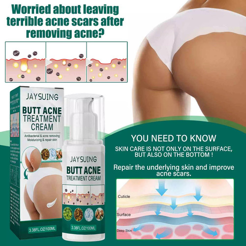 Crema Reparadora Para El Acné De Glúteos, Crema Hidratante,