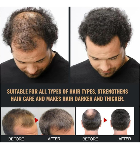 Shampoo Spartan Para Cabelo, Shampoo Ativador De Raiz Sparta