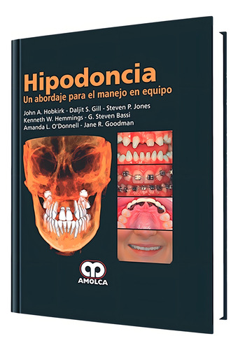 Hipodoncia Un Abordaje Para El Manejo En Equipo Tapa Dura
