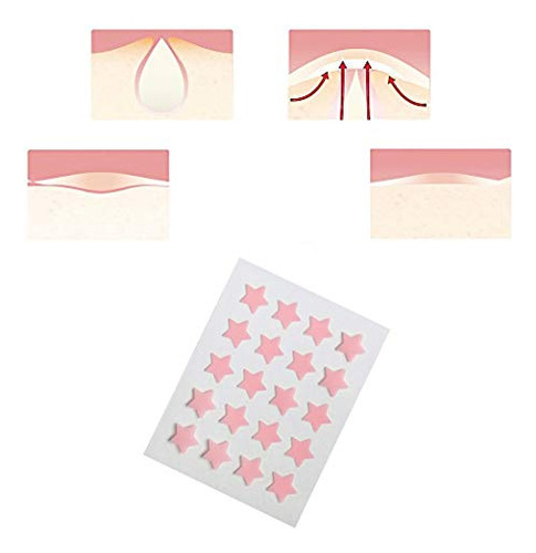 Acne Pimple Patch Agrcare Hydrocolloid Para Rosto (pacote Co