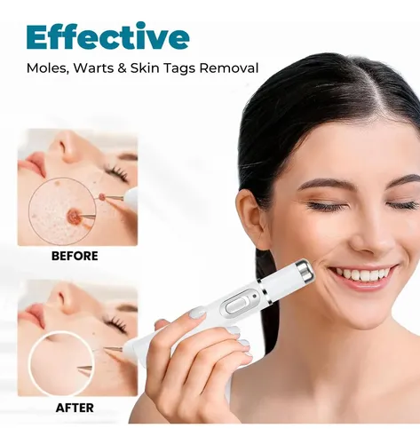 Lápiz De Terapia Con Luz Azul, Mejora La Piel Del Rostro Y E