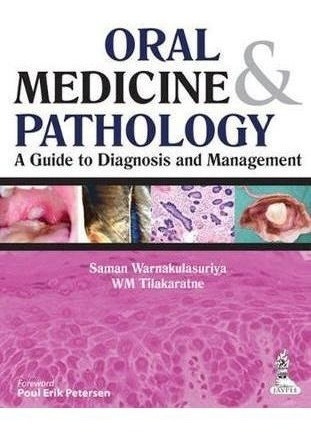 Oral Medicine & Pathology: A Guide To Diagnosis And Manag...