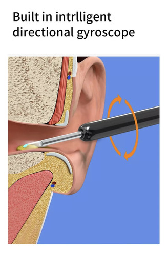 Limpiador Oído Otoscopio Inalámbrico Recargable Cámara Hd
