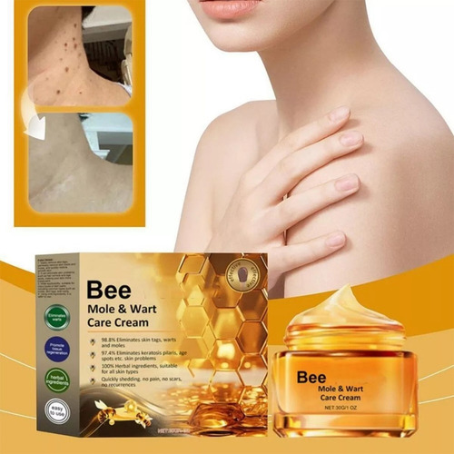 Fc Creme Removedor De Verrugas E Pintas2 Unidade 30g