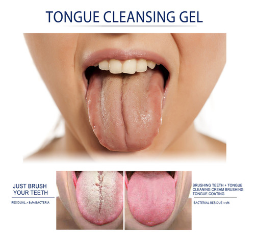 Gel Limpiador De Lengua De 2 Piezas, Kit De Cepillo De Limpi
