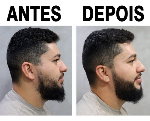 Imagem 6 de 9 de Escurecedor De Barba Preeche E Cobre Falhas + Shampoo