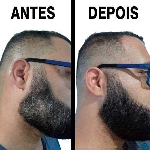 Imagem 5 de 9 de Escurecedor De Barba Preeche E Cobre Falhas + Shampoo
