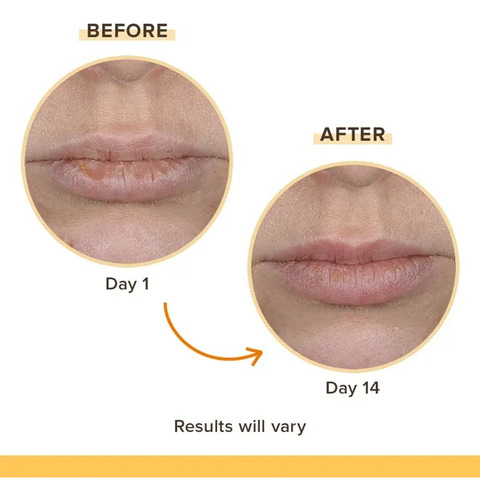 Bálsamo De Labios Burt's Bees Doble Hidrataciónsin Fragancia