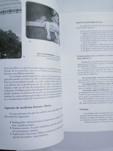 Libro Traumatología Forense / Eduardo Vargas Alvarado (Usado)