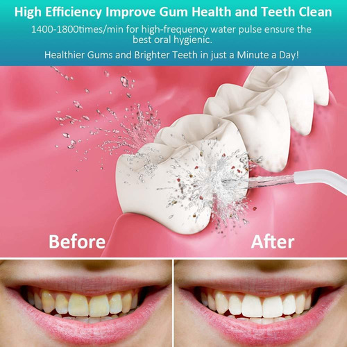Actualizar Inalámbrico Agua Flosser, Homgeek 320ml Oral Irri