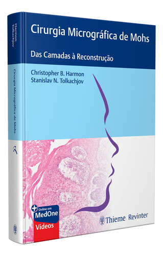 Cirurgia Micrográfica De Mohs