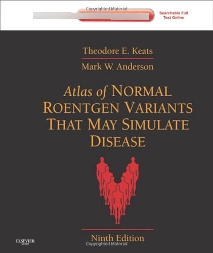 Libro Atlas Of Normal Roentgen Variants That May Simulate Di